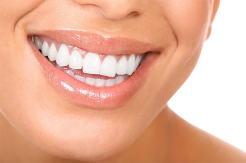 Do I Need Gum Disease Therapy? [QUIZ]
