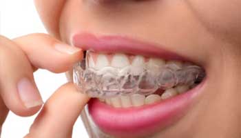 Recreate Your Smile With Invisalign! [VIDEO]